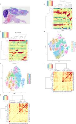 Characterization of the Tumor Immune Microenvironment in Lung Squamous Cell Carcinoma Using Imaging Mass Cytometry